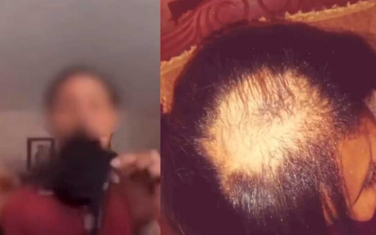 PELO