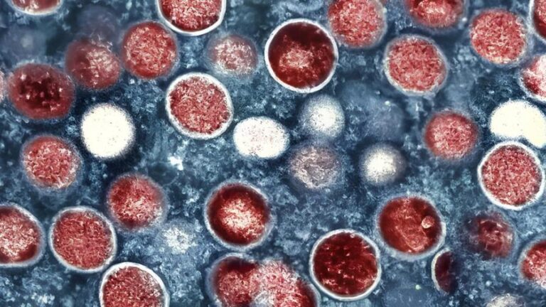 america-latina--aun-no-esta-prerapada-para-la-viruela-del-mono_1-focus-0-0-896-504