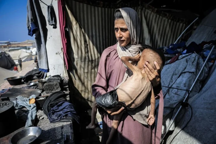 PALESTINA-Muhammad-Zakariya-Ayyoub-al-Matouq-de-un-ano-se-enfrenta-a-una-desnutricion-potencialmente-mortal-728x486